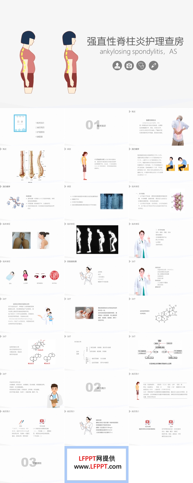 强直性脊柱炎护理查房PPT