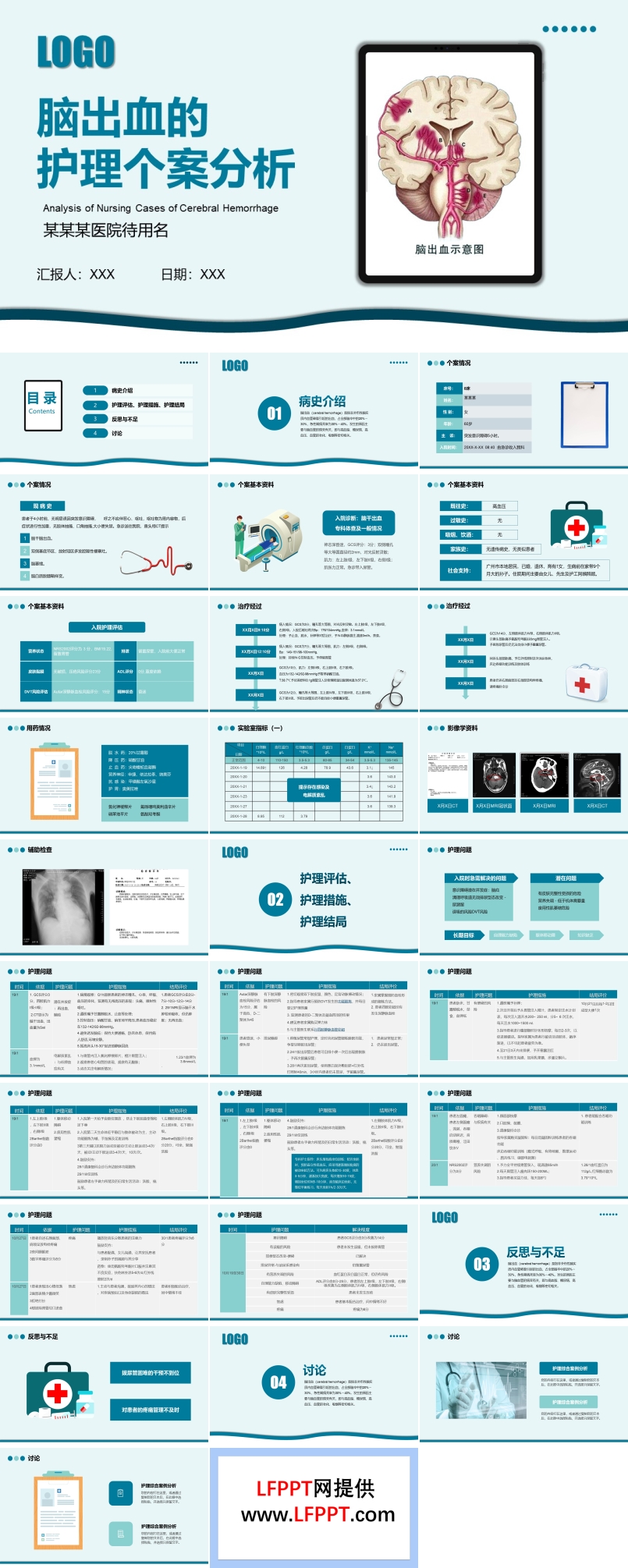 脑出血个案护理分析PPT