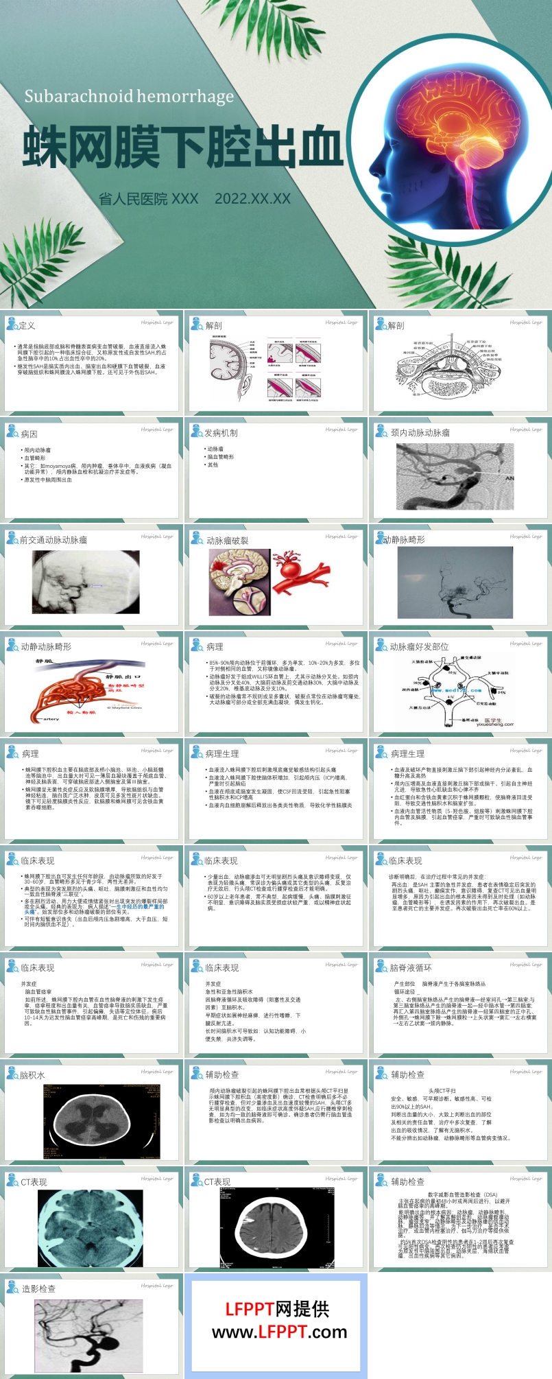 蛛网膜下腔出血PPT