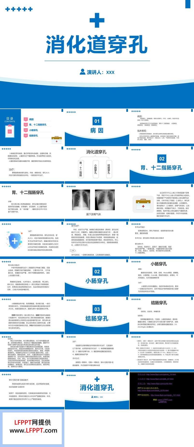 消化道穿孔医疗课件知识PPT